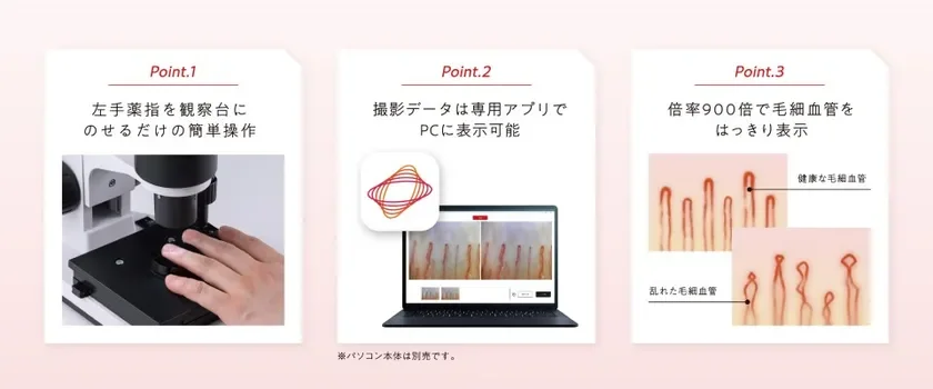 VITAL SCANのポイントと毛細血管の画像