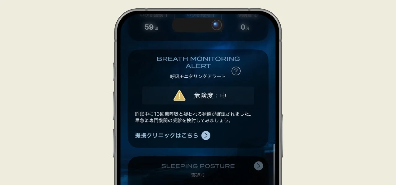 呼吸モニタリングアラート