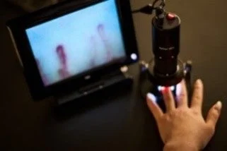 指先の毛細血管観察