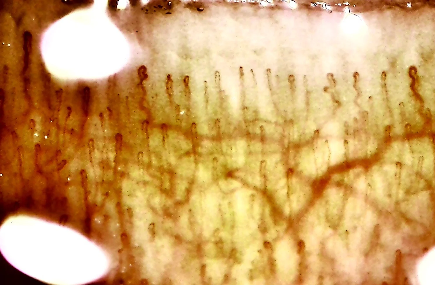 微細な生体組織を捉えた顕微鏡写真で、多数の毛細血管のような細い管状構造が複雑に絡み合っています。