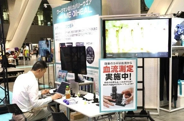 血流測定 実施中!