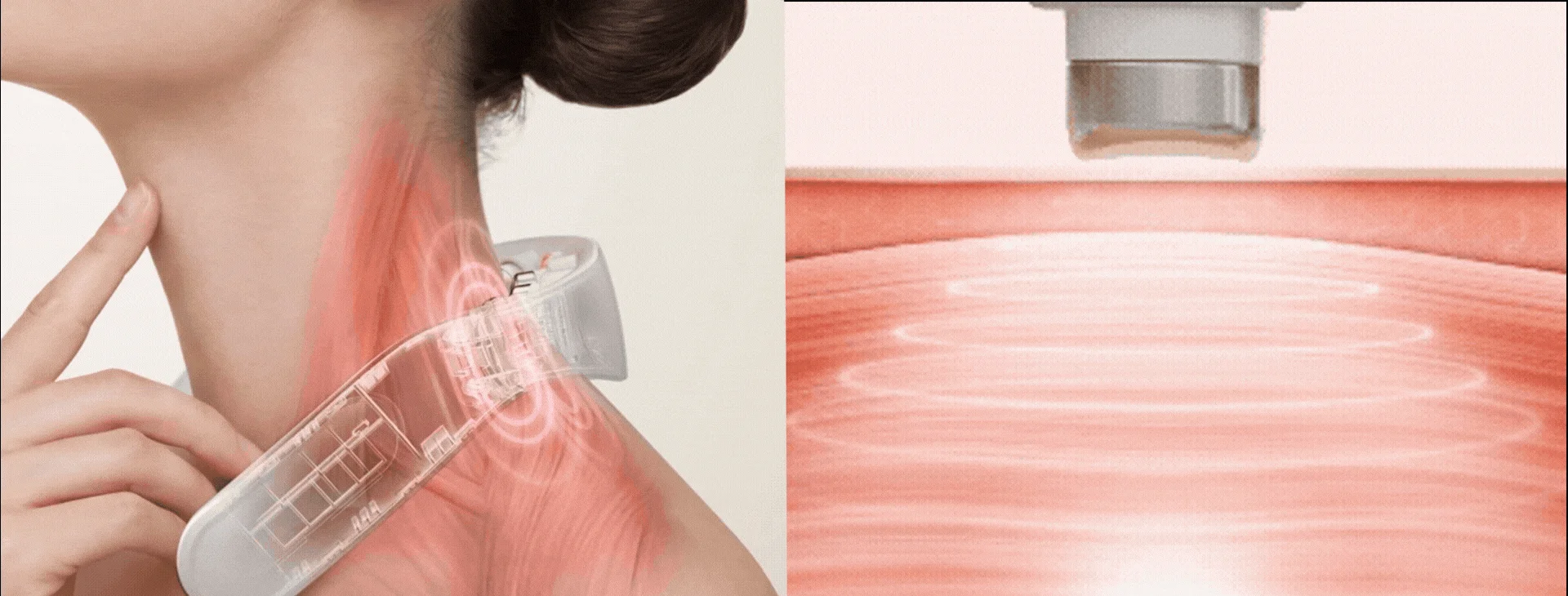 首と肩の筋肉に美容機器を適用している様子