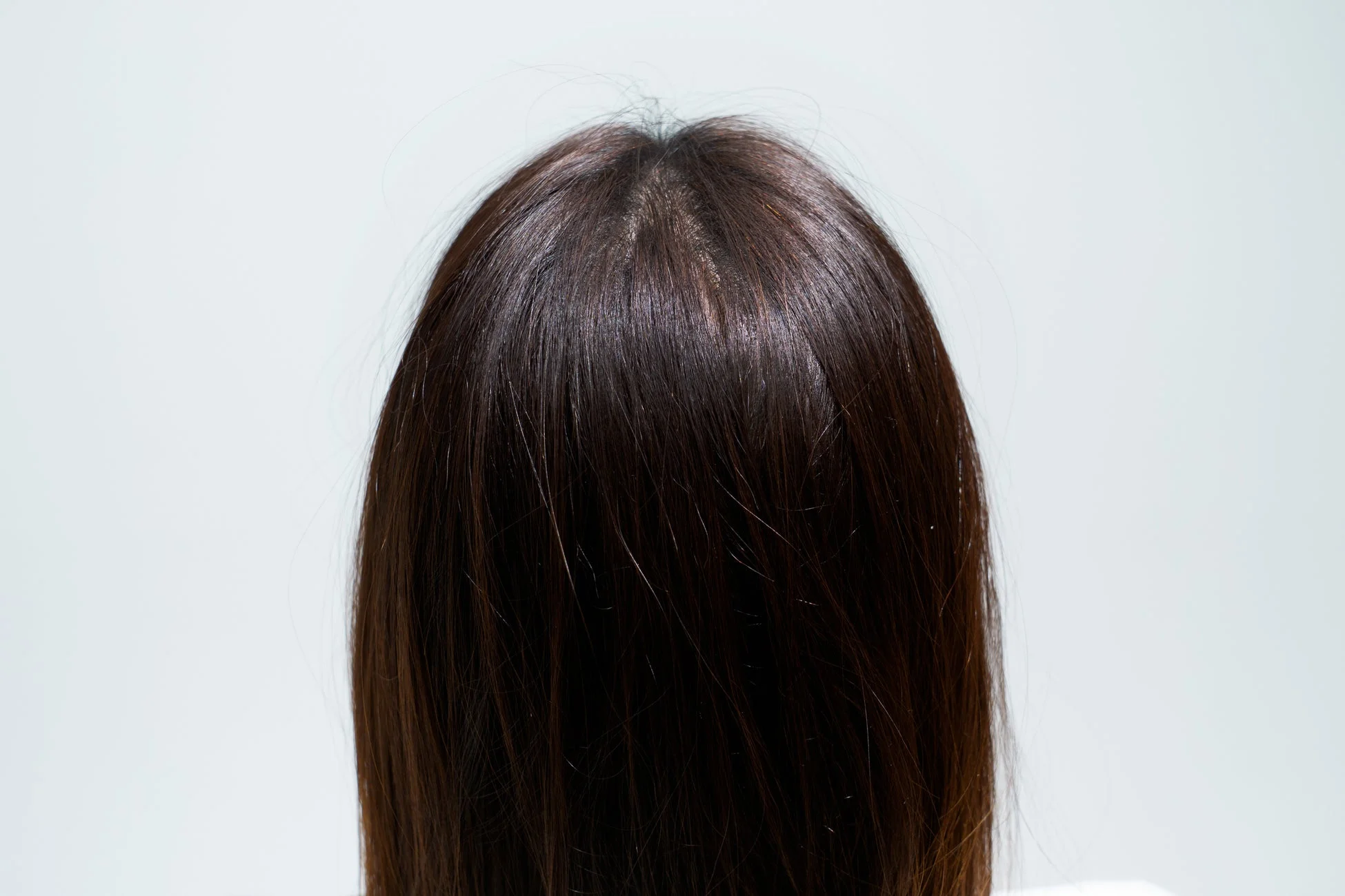 後頭部から見た女性の髪と頭皮