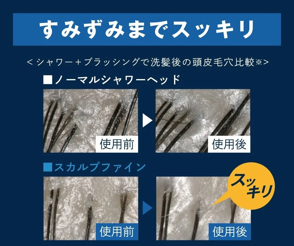 シャワーとブラッシングによる洗髪後の頭皮毛穴の比較画像