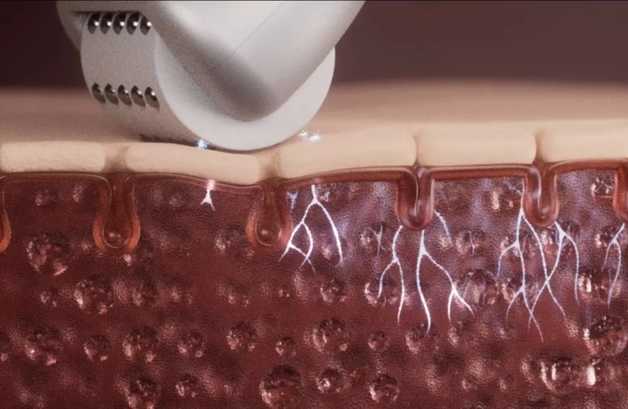 肌への作用イメージ