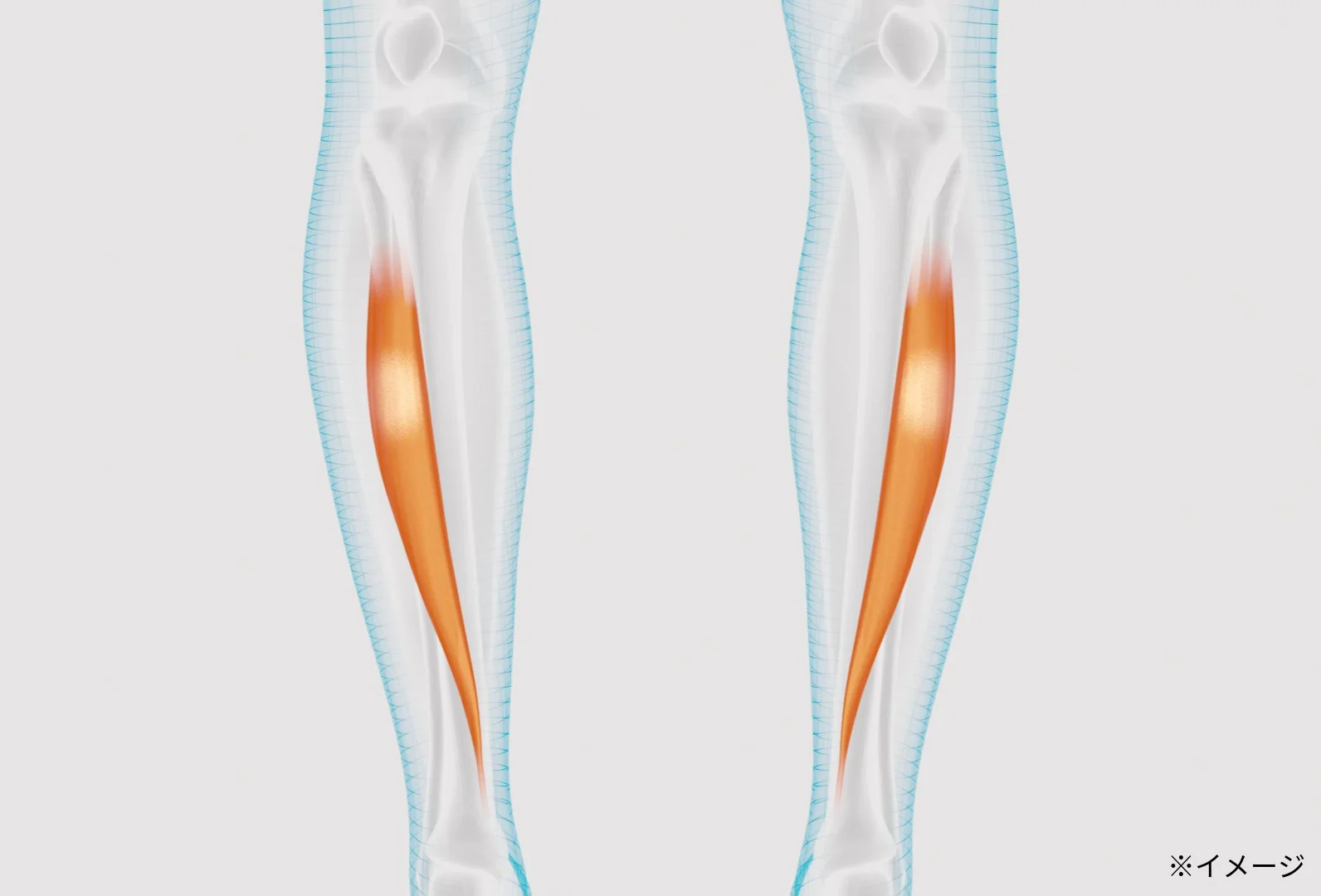 人間の下腿(ふくらはぎ)の筋肉、特に腓腹筋がオレンジ色で強調された3D解剖学的イラスト。骨格も透けて見え、医療や健康関連の文脈で使用されるイメージ画像です。