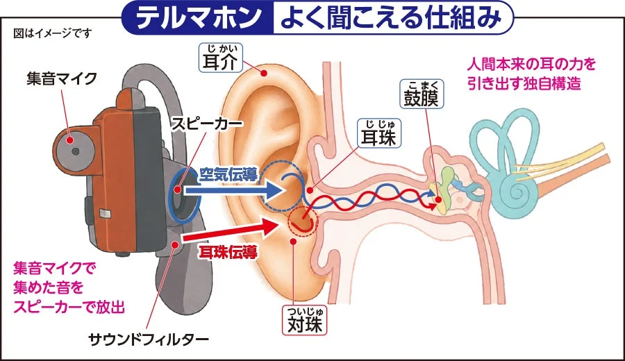 テルマホン よく聞こえる仕組みの図